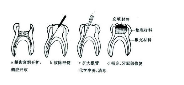 成都義齒產(chǎn)業(yè)在國際市場上的地位如何？? | 成都義齒廠家